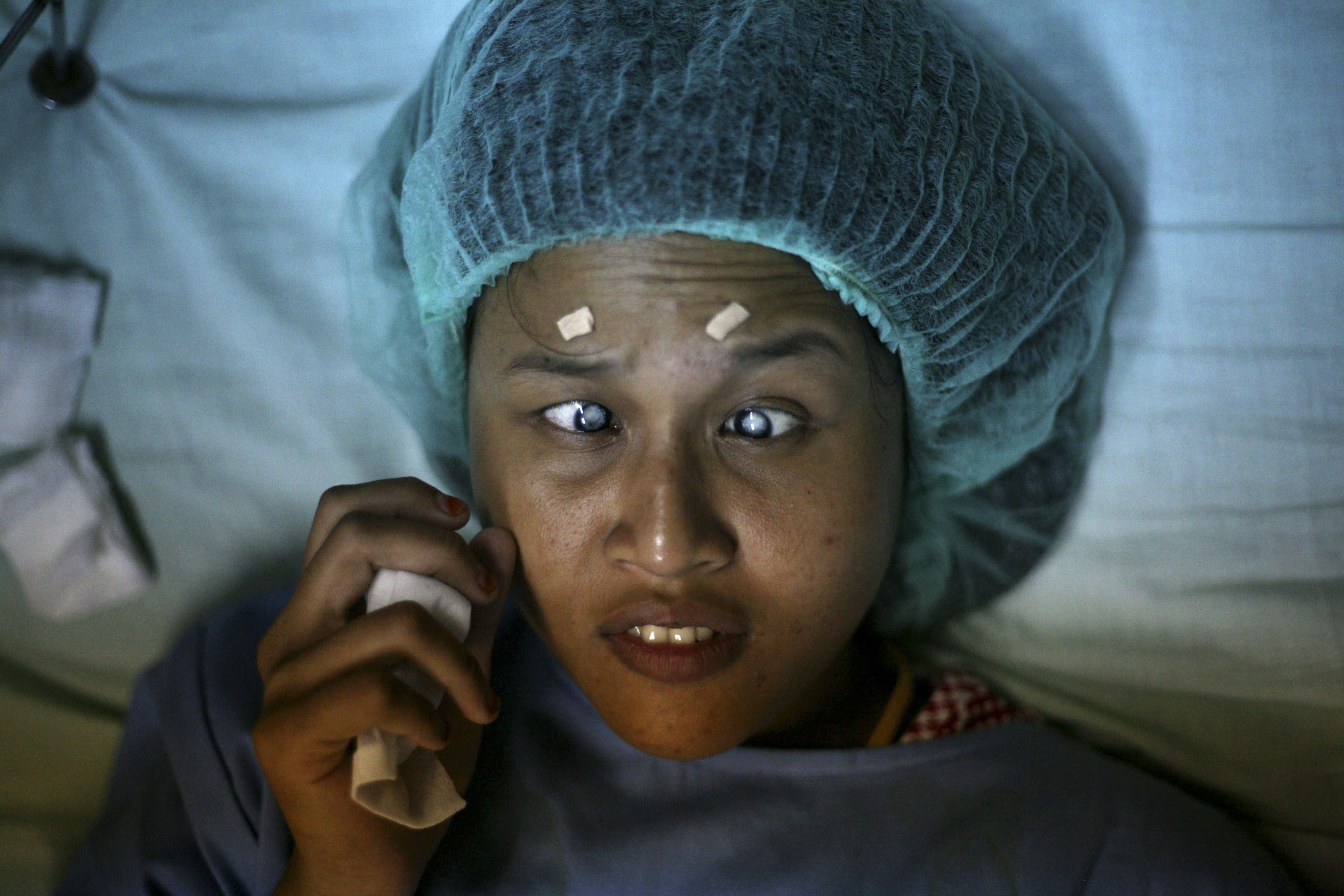 AP PHOTOS Simple surgery heals blind Indonesians